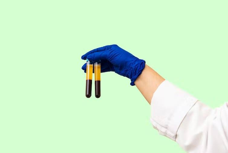 How do blood tests work? Medical laboratory scientists explain the